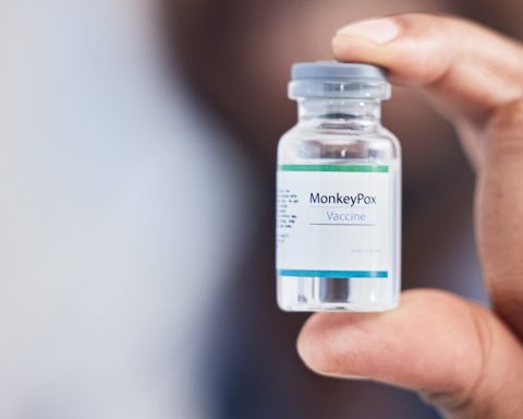 Mpox Case in Pietermaritzburg Confirmed